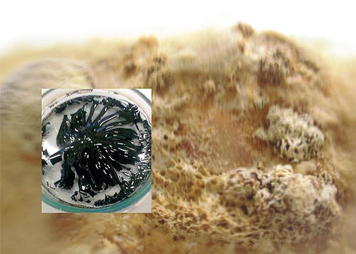 Shpëtoni nga dhimbja e muskujve dhe kockave! Trajtimi i thjeshtë që funksionon!